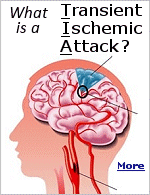 When you have a TIA, the flow of blood to part of your brain gets cut off for a short time. It's also called a ministroke.